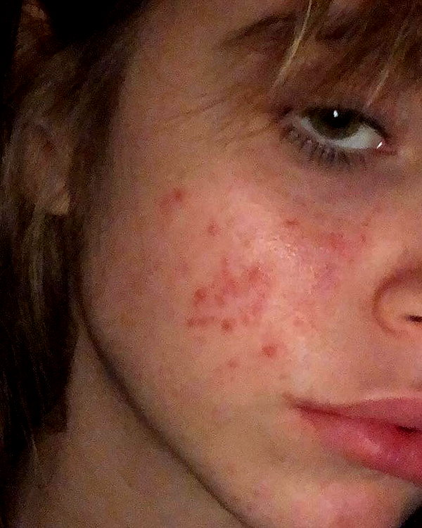 Archived image from @lolabllue on Instagram