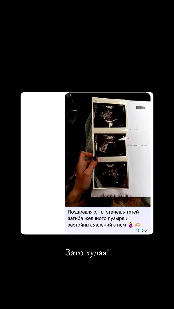 kkwwwv instagram image archive image