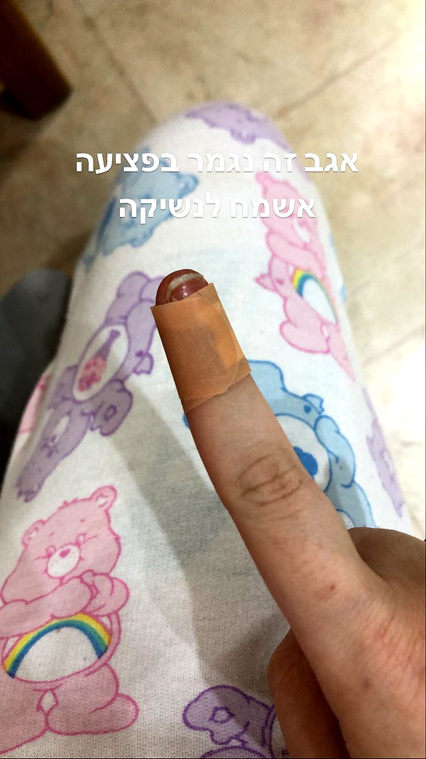 Archived image from @notchicore on Instagram
