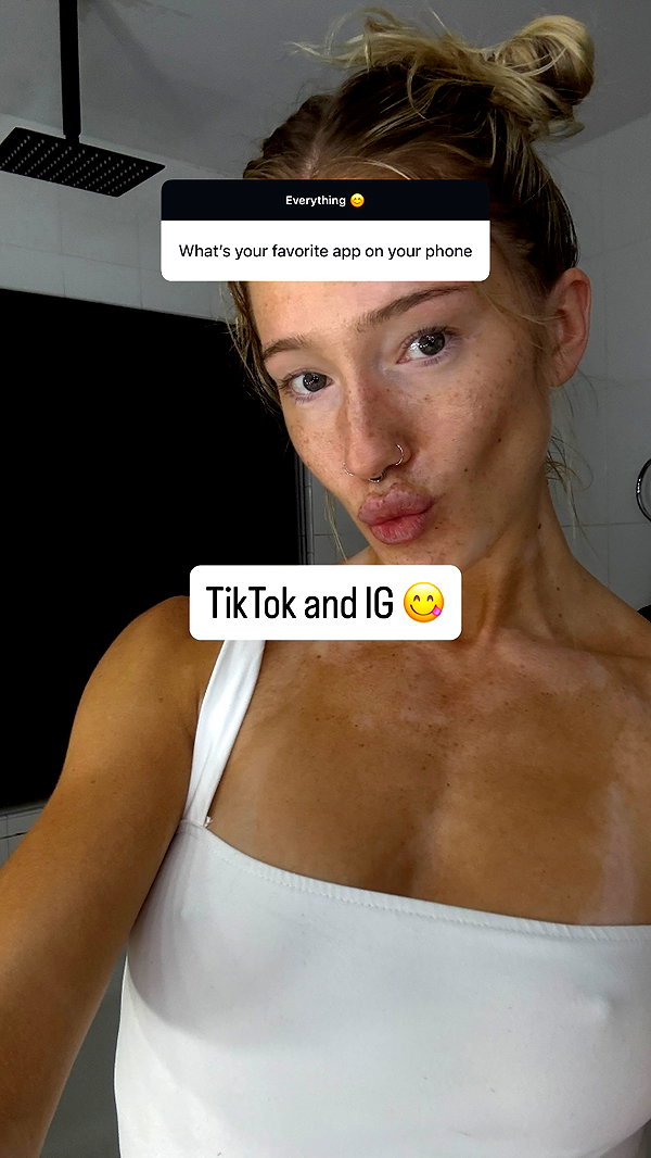 frecklesalanna frecklesalanna archive image