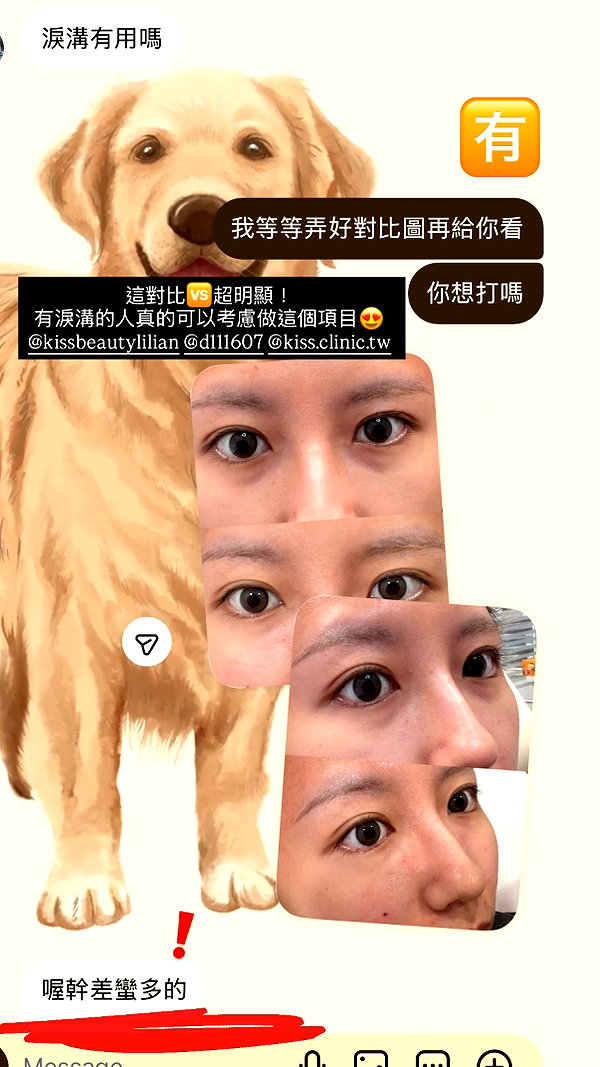 4ure1i2 instagram image archive image