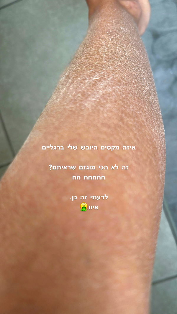 barzomer instagram image archive image