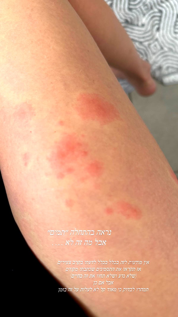 barzomer instagram image archive image