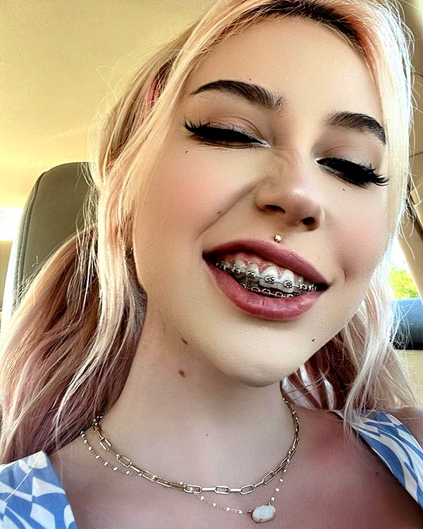 bunnyhazed instagram image archive image