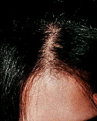 ting851204 ting851204 archive image