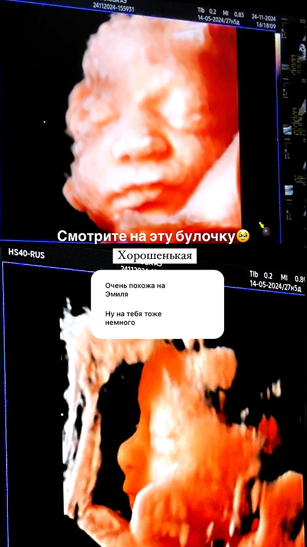 enikeeva_aliya instagram image archive image