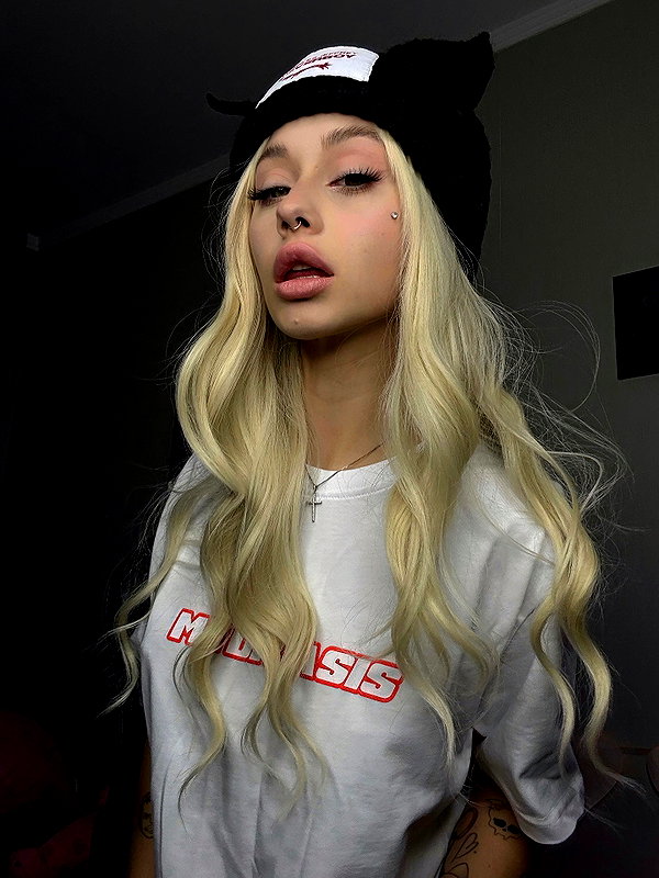 mydriasislive instagram image archive image