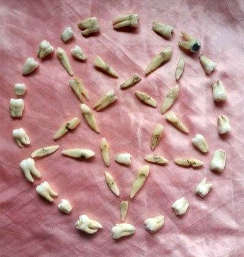 jtilb image ~ Altpins