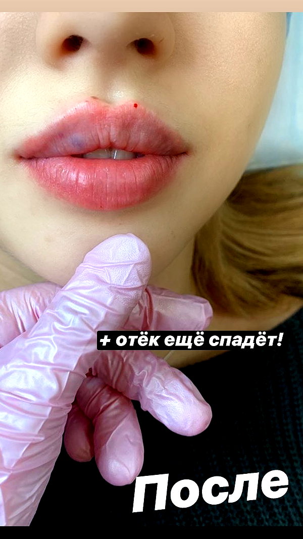 pokrov90 instagram image archive image
