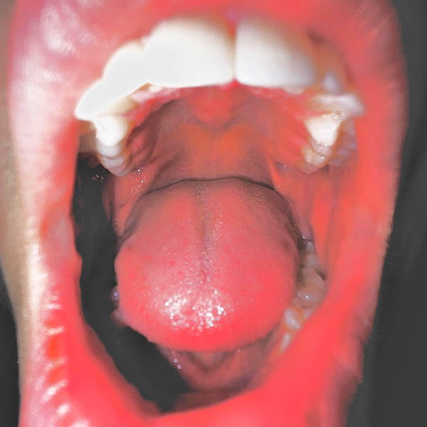 bugz4brainz instagram image archive image
