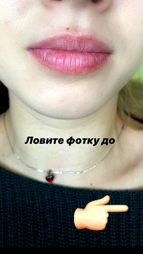 pokrov90 instagram image archive image