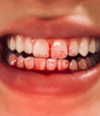 bugz4brainz Altpins Profile Picture