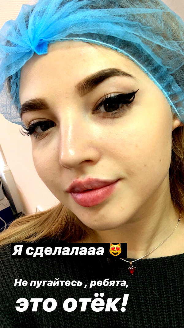 pokrov90 instagram image archive image