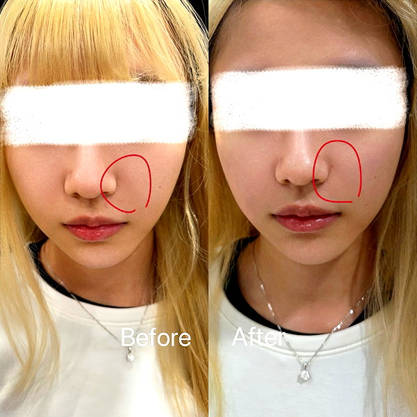 4ure1i2 instagram image archive image