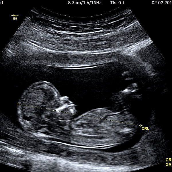 lilbieber instagram image archive image