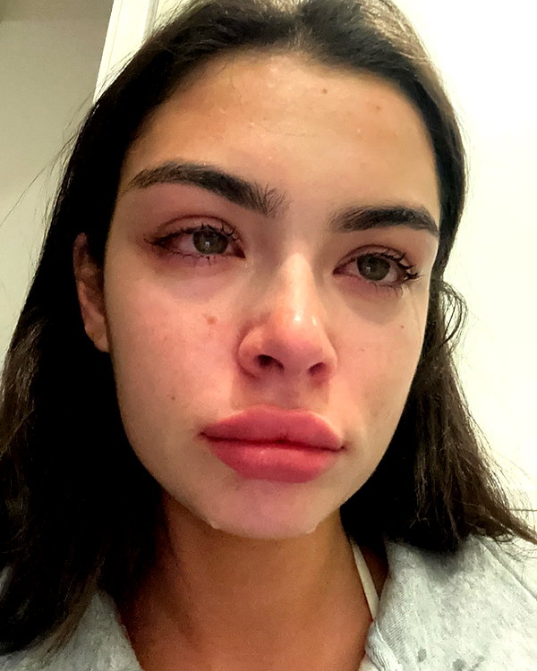 oliviaphillipps instagram image archive image