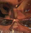 bugz4brainz Altpins Profile Picture