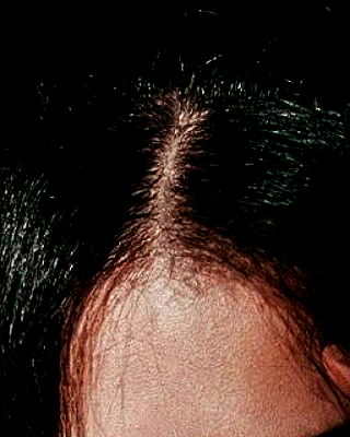 ting851204 ting851204 archive image