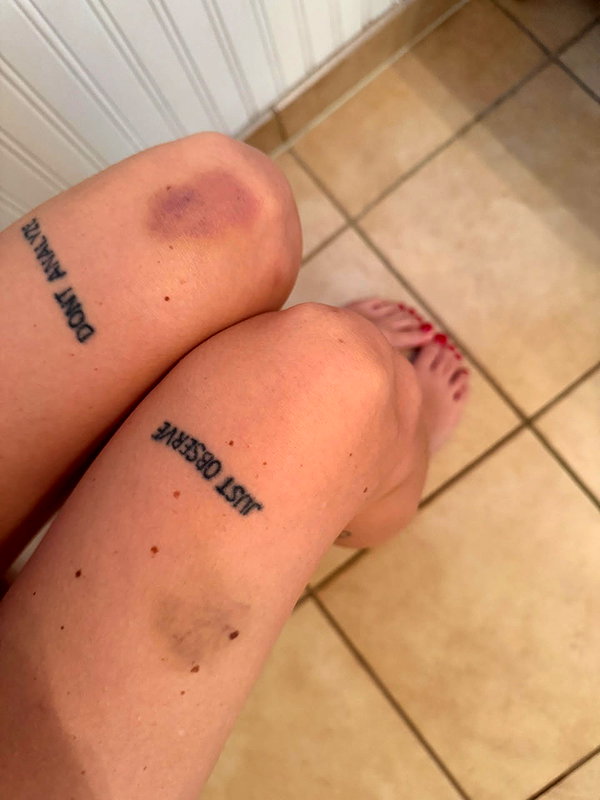 smashedely instagram image archive image