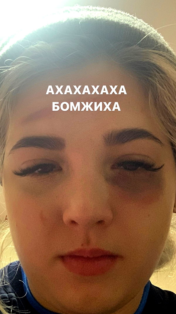pokrov90 instagram image archive image