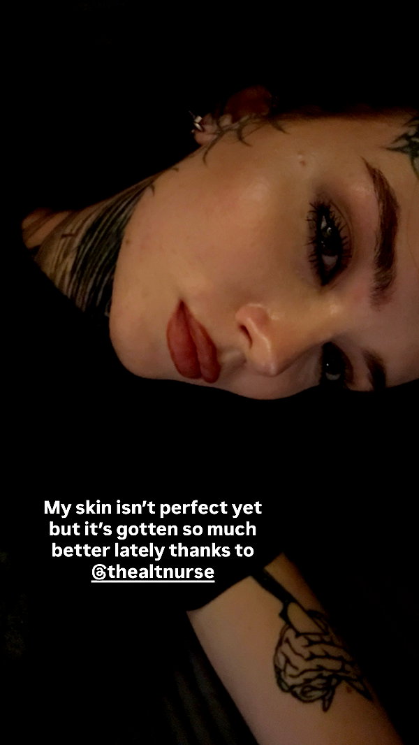 Archived image from @nikkibitez on Instagram
