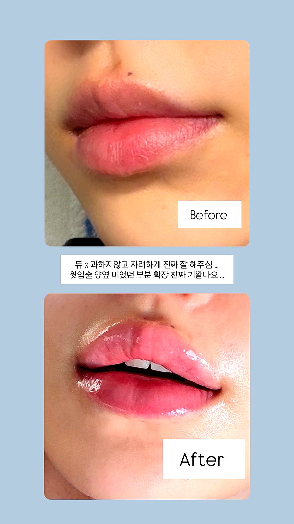daxbin instagram image archive image