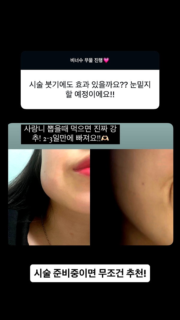 its.yeonimom instagram image archive image