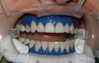 lowrtown Altpins Profile Picture