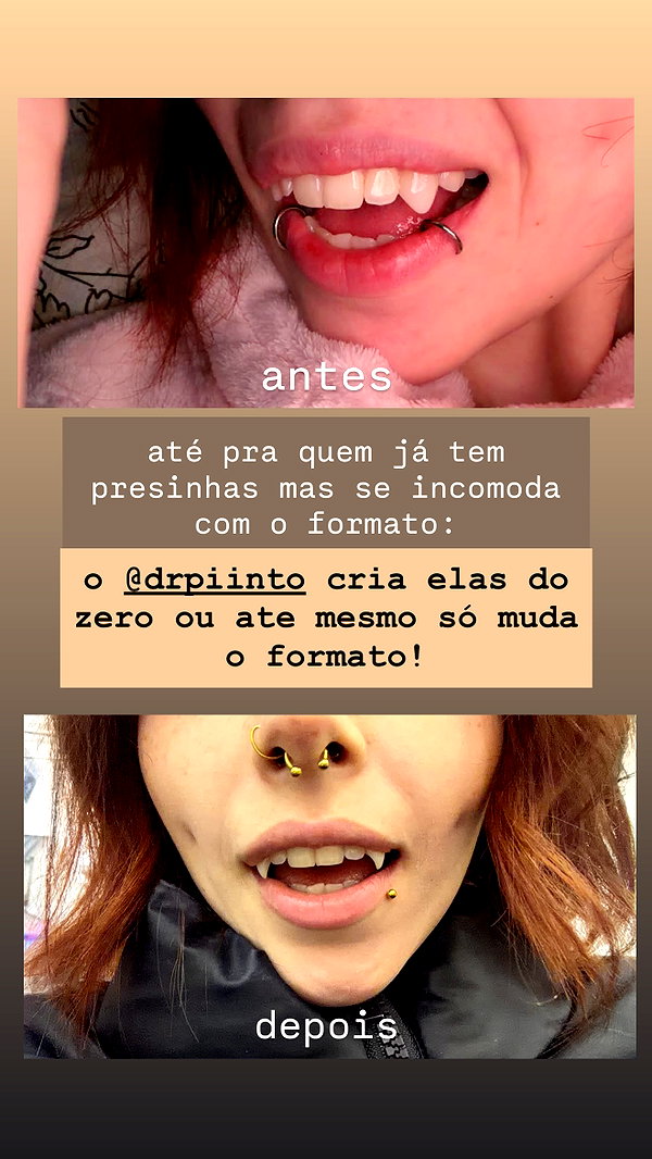 fractus.vamp instagram image archive image