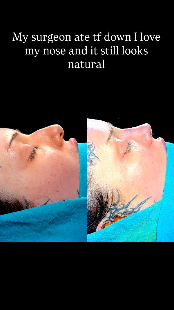 nikkibitez instagram image archive image