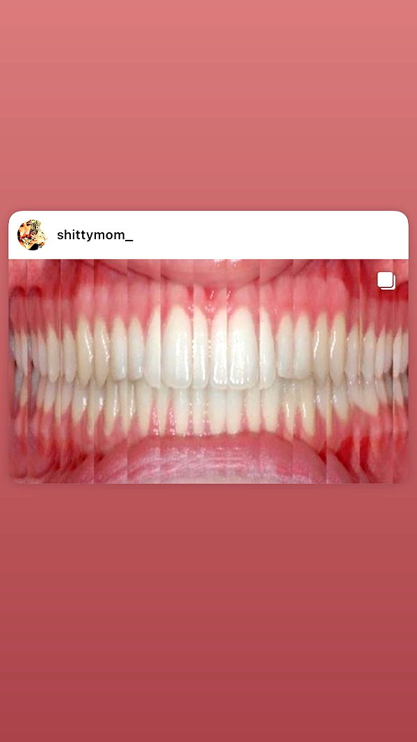 babynympho_archive instagram image archive image