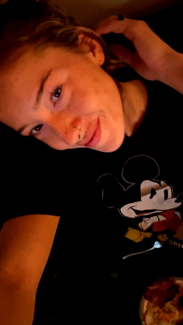 frecklesalanna frecklesalanna archive image