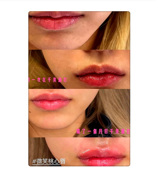 4ure1i2 instagram image archive image