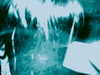 bugz4brainz Altpins Profile Picture