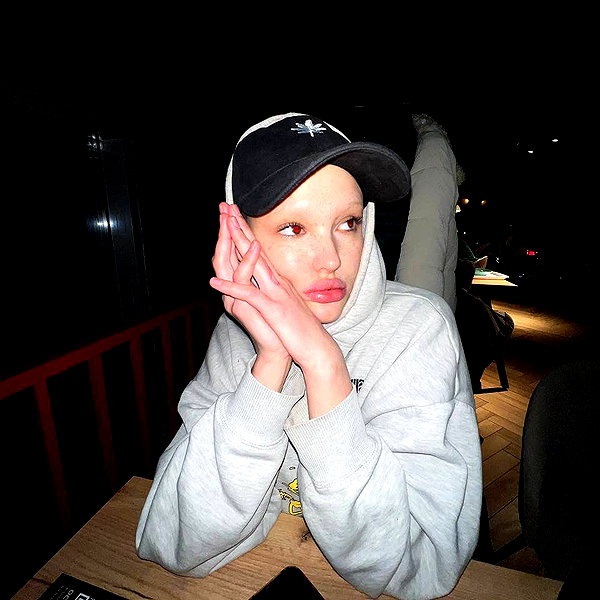 dope2shine instagram image archive image