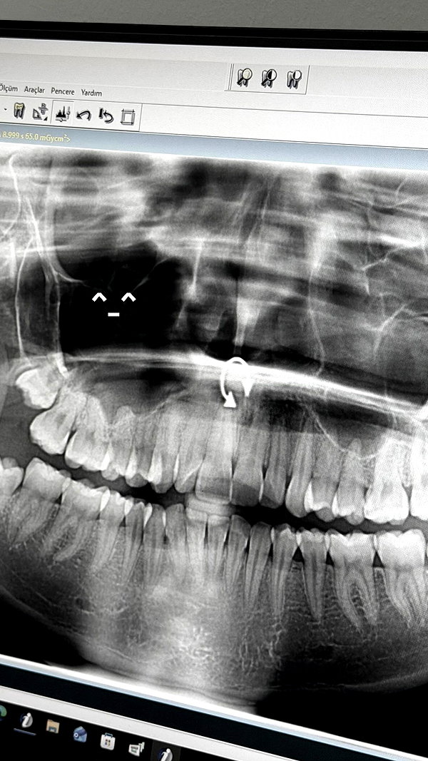 dilwwyy archive image