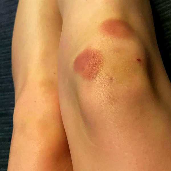 billieeilish instagram image archive image