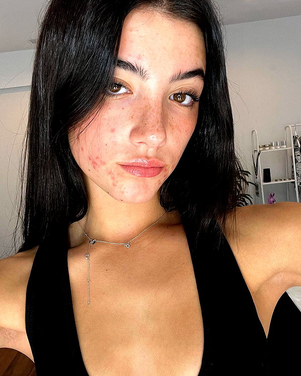 charlidamelio instagram image archive image