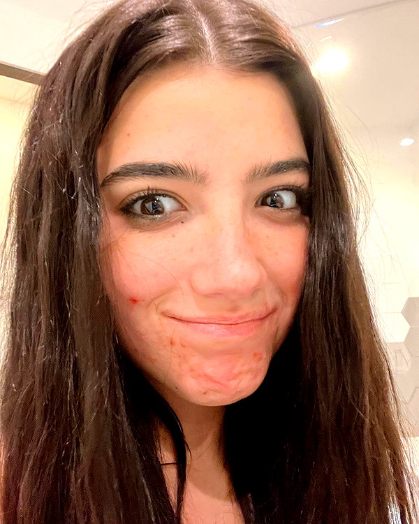 charlidamelio instagram image archive image