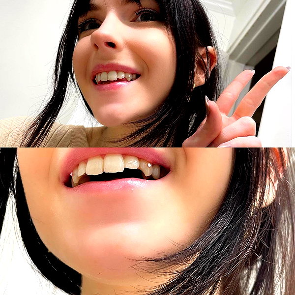 frankiebuns instagram image archive image