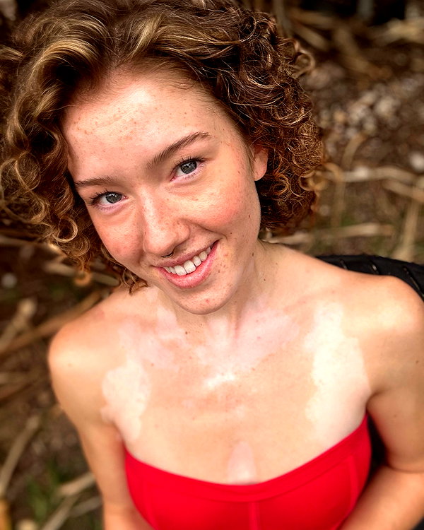 frecklesalanna instagram image archive image