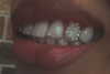 jzabessa Altpins Profile Picture