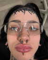 magg0tfleshh Altpins Profile Picture
