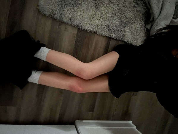 myworstmisery instagram image archive image