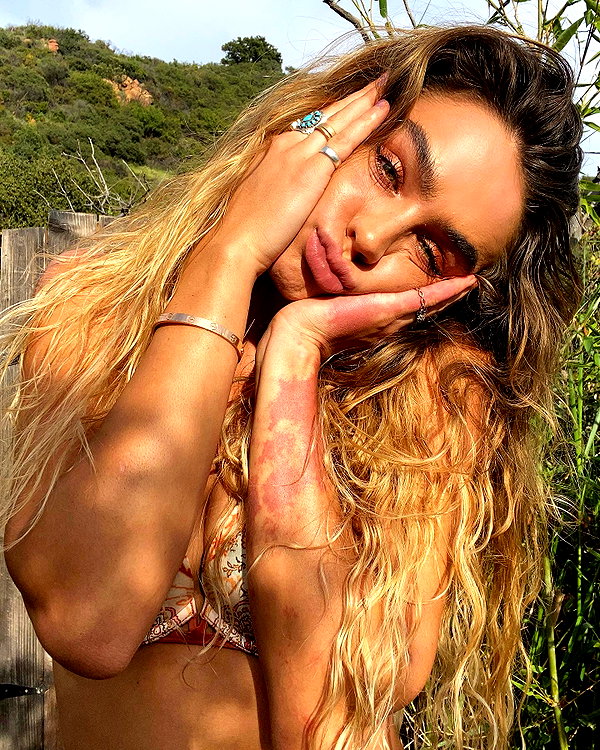 sommerray instagram image archive image