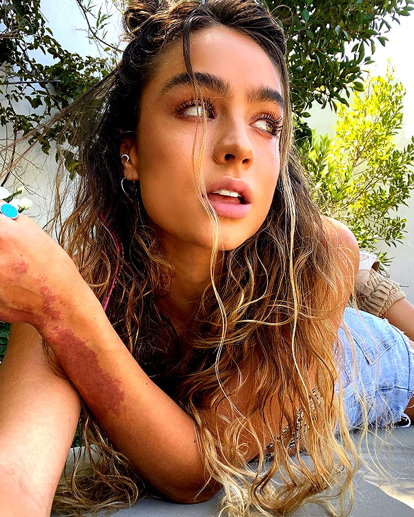 sommerray instagram image archive image