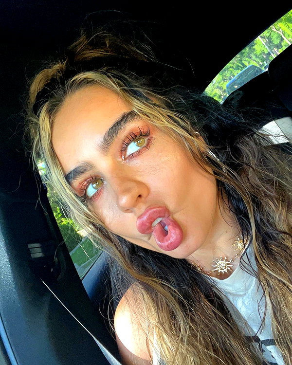 sommerray instagram image archive image