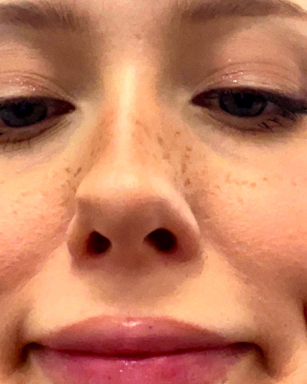 linzor instagram image archive image