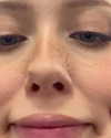 linzor Altpins Profile Picture