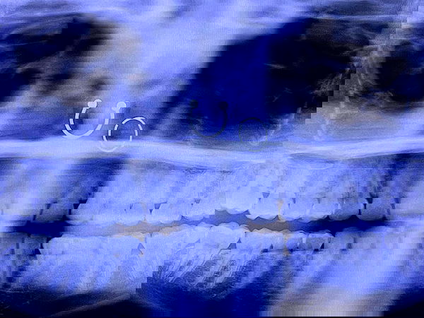 llilbby llilbby archive image